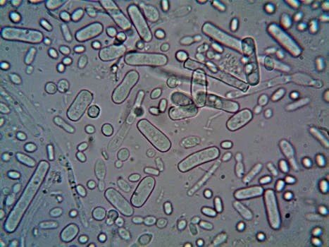 mbr vs conventional activated sludge comparison - Frequently Asked Questions