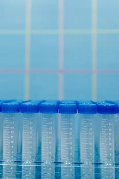 reverse osmosis vs ultrafiltration which is better - When to Choose Reverse Osmosis