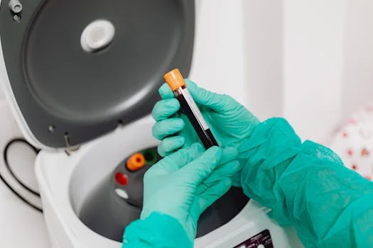 hospital wastewater treatment in istanbul - Frequently Asked Questions