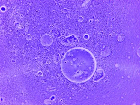 how does micro bubble flotation work - Frequently Asked Questions