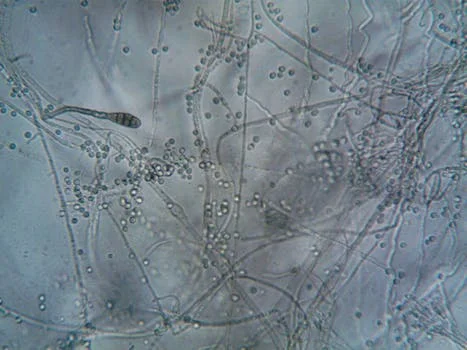 what is mbr membrane bioreactor - MBR Membrane Specifications: Pore Size, Flux Rates, and Material Science