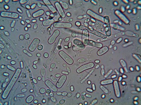 ammonia wastewater treatment by MBR - How MBR Systems Remove Ammonia: Biological + Membrane Mechanisms