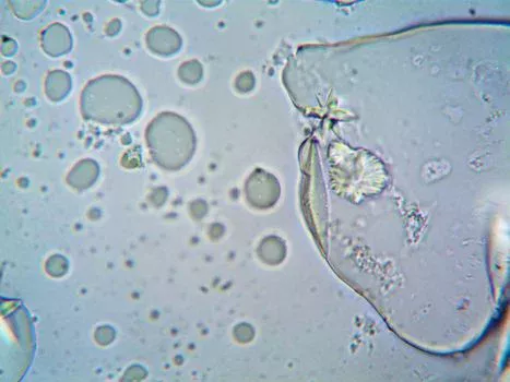 mbr membrane bioreactor working principle - MBR Membrane Fouling: Causes, Prevention, and 2025 Mitigation Strategies