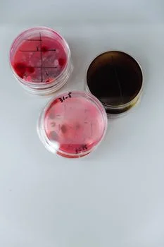 how to treat high-salinity wastewater - Salt-Tolerant Biological Treatment: MBR and Halophilic Microbes
