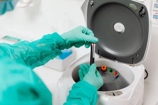 how to treat IPA wastewater - CAPEX and OPEX Breakdown: 2026 Cost Models for IPA Wastewater Systems