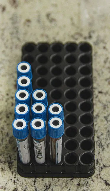 How to Measure Cyanide Correctly for DENR Compliance