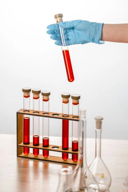 Influent Characterization: What to Test Before You Pick Equipment