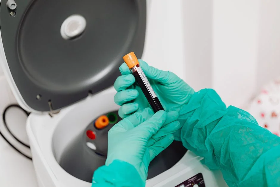 Nutrient Recovery Technology Comparison: Recovery Rate, End-Product and CAPEX