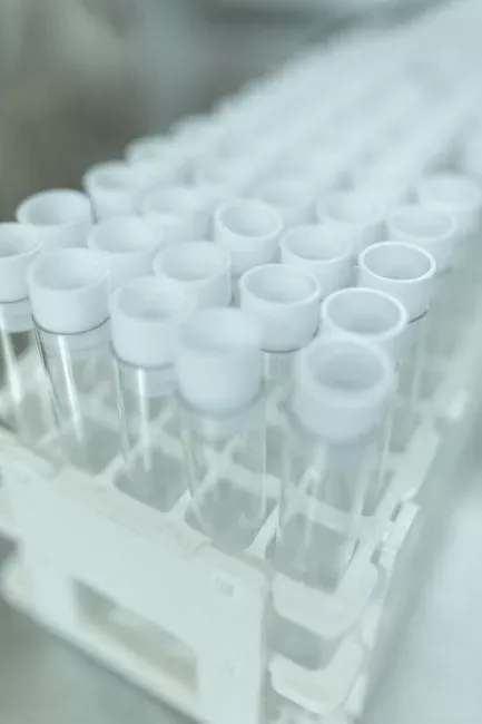 Removal Performance: What Effluent Quality an SBR Actually Delivers